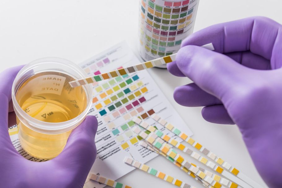 Sports law: the history and development of anti-doping rules